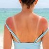 Take the test that reveals how likely you are to get deadly skin cancer