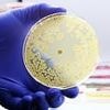 Huge surge in stomach bug linked to tainted SALAD could explain explosion of colon cancer in young people, disturbing new study suggests