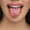 Gel used to smooth out facial wrinkles could be used to treat dry mouth after scientists grow saliva gland in a dish