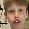 Polizei sucht Bernard: Autistischer Junge ist wieder verschwunden