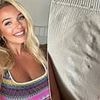 Woman left in 'agonising' pain from second degree burns - after shorts she bought from TikTok 'melted' into her skin