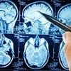 First subtle sign of dementia that can strike 20 years before disease sets in - as experts discover the condition has a 'stealth phase'