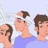 TÉMOIGNAGES. « J’avais un front interminable » : ils ont fait une greffe de cheveux