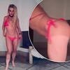 Britney Spears shows off painful sunburn in a bright pink bikini