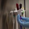 Cancer du sein : une prise de sang pour détecter la rechute