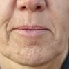 The everyday item that could be giving you WRINKLES - as experts compare the effect to 'smoker's lines'