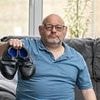 Groom forced to have his toes partially amputated after being given wedding shoes that were too tight