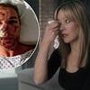 'He was so scared, he just stared at me': Andrew Flintoff's wife recalls harrowing moment she saw star's gruesome injuries
