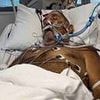 Footy legend Sam Backo is unrecognisable in intensive care as he battles life-threatening tropical disease that has killed 34 Aussies this year alone