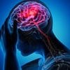Plastic pollution in the blood: Stroke victims found to have more than 50 times the amount of microplastics in their arteries compared to healthy individuals