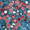 Krankheiten: Mehr Fälle von Mpox – aber Experte bislang gelassen