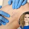 I hate the ugly veins in my legs... is there a way to get rid of them? DR ELLIE reveals the treatments available - and the simple seating position that can help