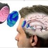 Les ultrasons, nouvel outil contre la dépression
