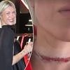 Influencer nearly 'decapitated' in freak wardrobe accident as she issues urgent warning for other women