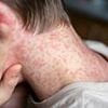 Frightening map reveals US counties where world's most infectious disease is set to surge