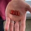 Doctors try 'poo pills' to flush out dangerous superbugs