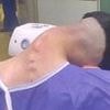 Man, 23, develops shocking 'dropped head syndrome' after battling addiction to one habit for years