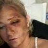 How Virginia Giuffre's life turned to hell after Prince Andrew's multi-million pound payout: From messy marriage breakdown to bizarre bus crash and spate of hospital admissions