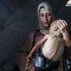 'I'm so tired': Mother of starving Gazan baby speaks to BBC
