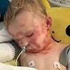 Boy, four, left with horrendous facial burns after freak accident at Oklahoma children's museum