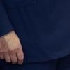 White House says Trump diagnosed with vein condition after questions about bruises