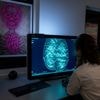 Vijf minuten is genoeg om borstkanker op te sporen; MRI-scan kan bij screening veel korter