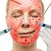 Wat doet een draadlift? En hoe zit het met botox? Dermatologen scheiden zin van onzin in de strijd tegen huidveroudering