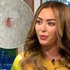 Natasha Hamilton reveals secret cancer battle in emotional Good Morning Britain interview - after mistaking warning signs for mosquito bite