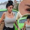 Katie Price displays extreme weight loss and a painful-looking eye injury as she arrives for the first night of her and Kerry Katona's tour in Lancashire