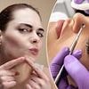 I popped a pimple in the 'Triangle of Death' and ended up with a deadly infection