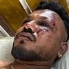 British Air India crash survivor reveals how he was the only passenger able to free himself and get out of the doomed plane alive
