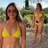 Louise Thompson proudly displays her stoma bag in a yellow bikini as she admits she notices people staring at it and urges others to 'be kind'