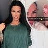 Katie Price comes under fire after her £2000 bald cat 'suffers with sunburn' -sparking new animal cruelty row