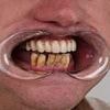 'I sawed out my rotting teeth with a shoelace-I thought it would be like shelling peas but I was very wrong'