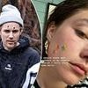 Acid burns, infections, dermal suffocation: Skin doctors reveal the hidden risks of Hollywood health craze