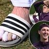 England cricketer opens up on why he almost had his toe AMPUTATED in bid to end injury hell... before doctors advised him against drastic move