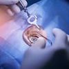 Alarming number of Lasik eye surgery patients who took their own lives revealed after police officer's suicide